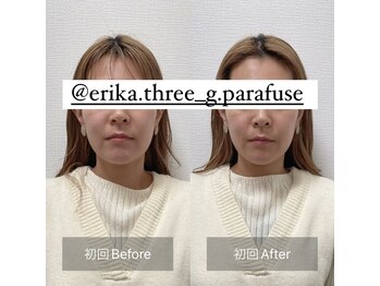 スリージー/before/after