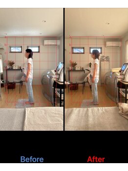 ヴィアージュ(viage)/筋膜リリースオイルマッサージ