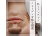 ［肌トーンUP×コラーゲン生成を促進］美顔(肌質改善)￥4000