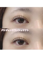 レディエント(Radiant)/パリジェンヌラッシュリフト