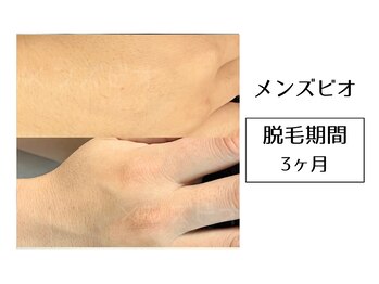 メンズビオ 神戸三宮店/