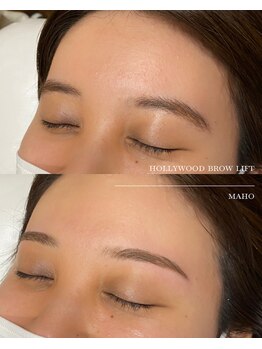 アタ(atha)/ハリウッドブロウリフト