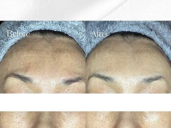 ラトナ(RATNA)/シルクスキン