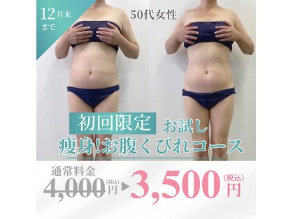 米子美人の写真