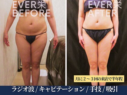 エヴァーグレース 北千住店の写真