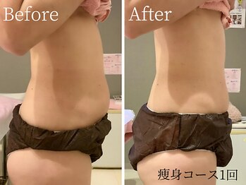 ビューティスト(Beautist)の写真/全身本気痩せ90分★脂肪燃焼&徹底引締めで満足度◎