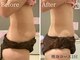 ビューティスト(Beautist)の写真/全身本気痩せ90分★脂肪燃焼&徹底引締めで満足度◎
