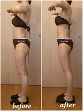 アンフィニ(infini)/ブライダルコース8回目（2ヶ月)