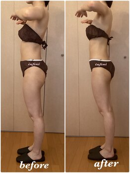 アンフィニ(infini)/ブライダルコース8回目(2ヶ月)