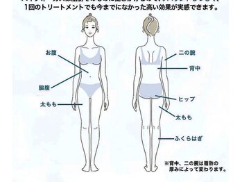 フェアリー/ボディ痩身 選べる箇所♪