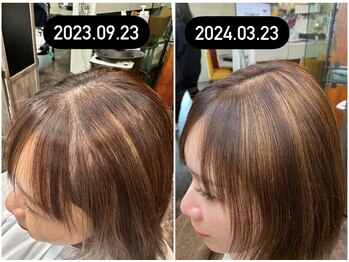 スパークル/フェイシャル/ワックス/脱毛