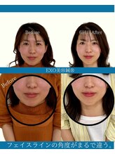 ハリラボ(hari Lab.)/【お客様の声】