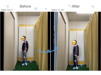 ひろがる接骨院 総社院/ビフォーアフター