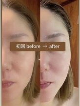 ラフォクシー(La.Foxy)/小顔コルギフェイシャル