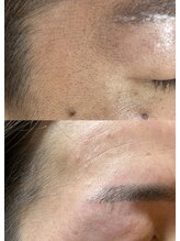 ルモア(Lumor)/フェイスワックス｜目周り