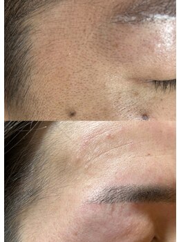 ルモア(Lumor)/フェイスワックス｜目周り