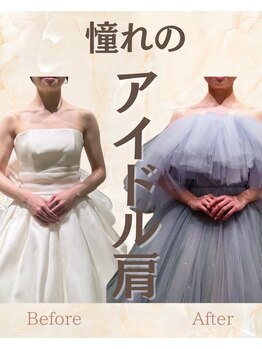 オハナ整骨院(Ohana整骨院)/肩の盛り上がり解消◎