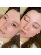アイラッシュ ティル(eyelash till)/まつげパーマ/眉毛スタイリング