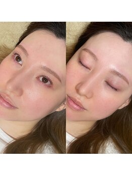 アイラッシュ ティル(eyelash till)/まつげパーマ/眉毛スタイリング