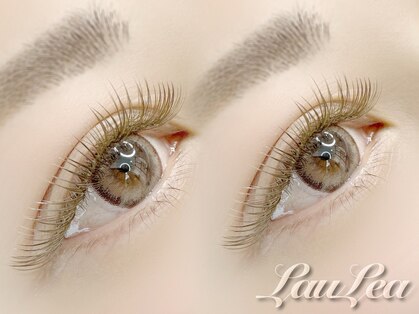 ラウレア(LauLea)の写真