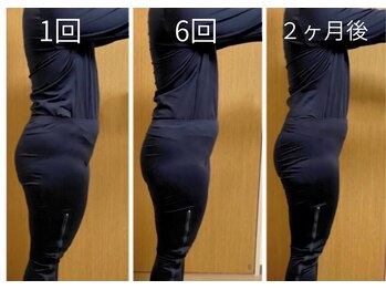 ヨサパーク ココロ 町田店(YOSA PARK COCORO)/Before After