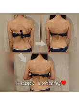 カルナボディ(Carna body.)/ブライダルエステ☆華奢な背中に