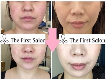ザ ファーストサロン(The First Salon)/フェイシャルの結果
