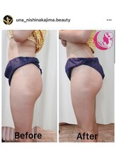 ウナトゥルービューティー(UNA true beauty)/ヒップアップも簡単