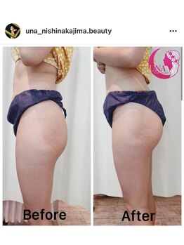 ウナトゥルービューティー(UNA true beauty)/ヒップアップも簡単