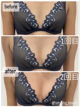 美バリ 新宿店(美BARI)/回数を重ねるごとにバストUP