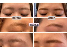 目が美きゅっと/韓国式【美眉脱毛】