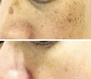 ソワンドゥース ヴェール(Soin douse Vert)