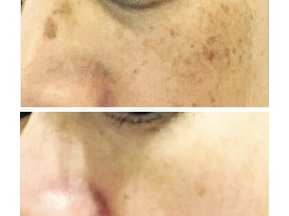 ソワンドゥース ヴェール(Soin douse Vert)の写真