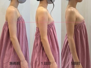 ロココ 四日市店(Rococo)/黄金比