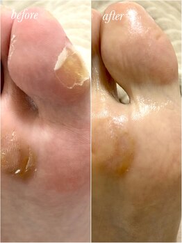 リゼラアンドコー 布施店/