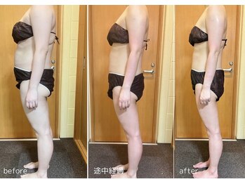 アンドワイ バイ サロンリーナ(&y by Salon Lena)の写真/結果重視!二桁痩せも目指せます◎下半身徹底ケアでスキニーをスリムに履きこなせる美脚・美尻を叶えます☆