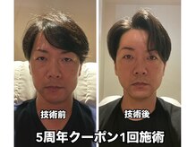 ゴクラク(GOKURAKU)/5周年クーポン凄いです！