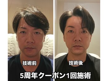 ゴクラク(GOKURAKU)/5周年クーポン凄いです！