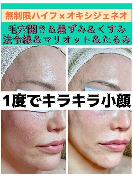 スペチアーレ 夙川/キラキラ小顔になれる！