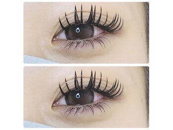 アイネ(eye:ne)/バインドロックつけ放題