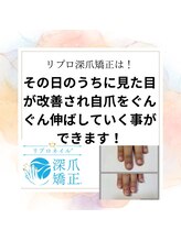 ブルームブルーム(BLOOMブルーム)/自爪育成