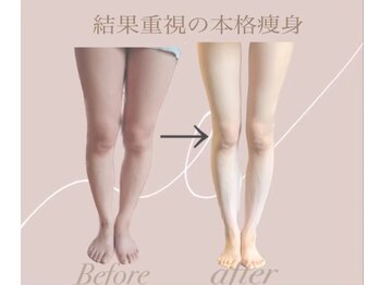 ヨサパーク ハーブメロディー 鈴鹿店(YOSA PARK)/美脚痩身