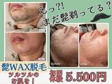 スマイルボディ つぼの森 伊集院店(Smile body)の雰囲気（全身～ご希望部分の脱毛ＯＫ！メンズ脱毛・VIO脱毛・WAX脱毛有♪）