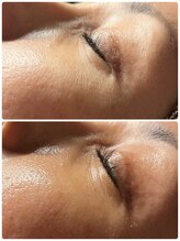 トータルビューティサロン シェリ(cheri)/フェイシャル