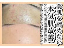 美肌への近道はまず自分の肌を知ることから♪