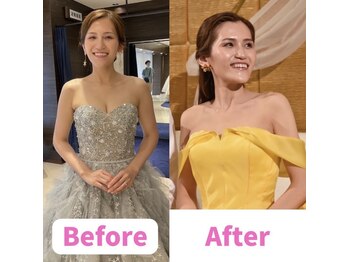 ボディキュア ブライダル美容整体 大阪梅田/【はみ肉撃退】憧れの花嫁像に