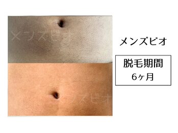 メンズビオ 神戸三宮店/