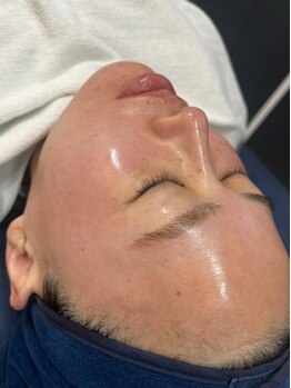 フローラル ビューティー(Floral-Beauty)の写真/素肌美人へ*お悩みの多いたるみやほうれい線を改善！しみしわ緩和！エイジングケアが出来るトータルサロン