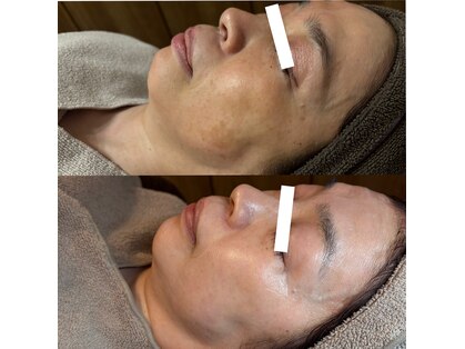 エステドルース(esthe de Ruth.)の写真