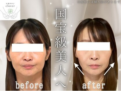 クローバー(clover)の写真